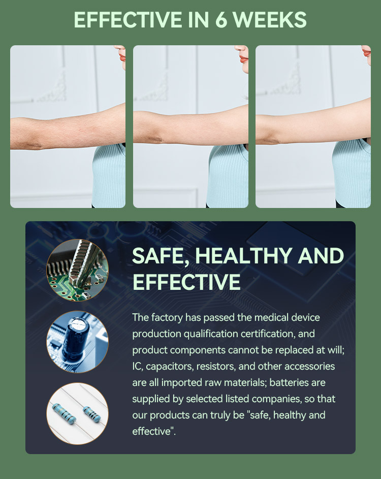 SKB-2128 Portable IPL Hair Removal Device